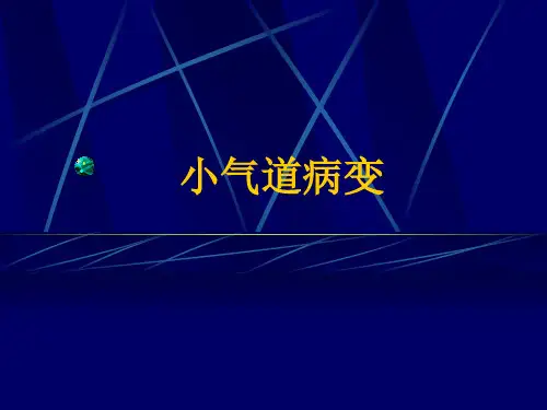 小气道病变_图文-PPT文档资料59页