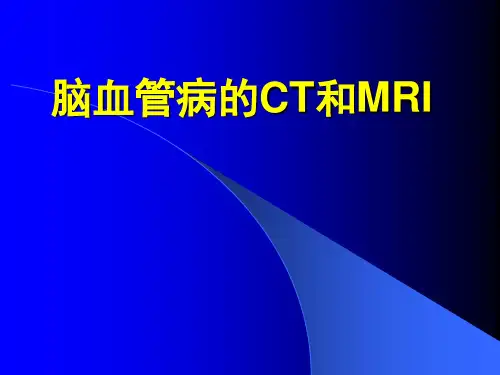 脑血管病的CT和MRI
