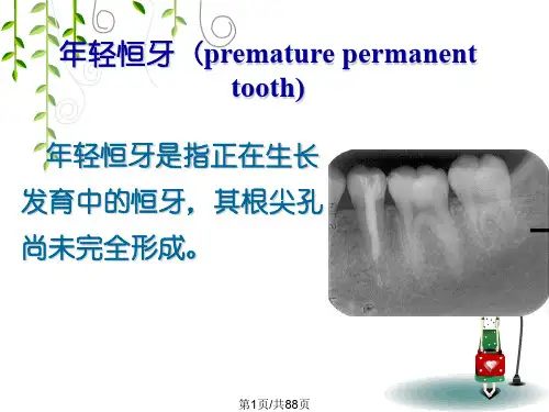 年轻恒牙牙髓病和根尖周病120
