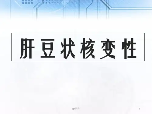 肝豆状核变性精简版  ppt课件