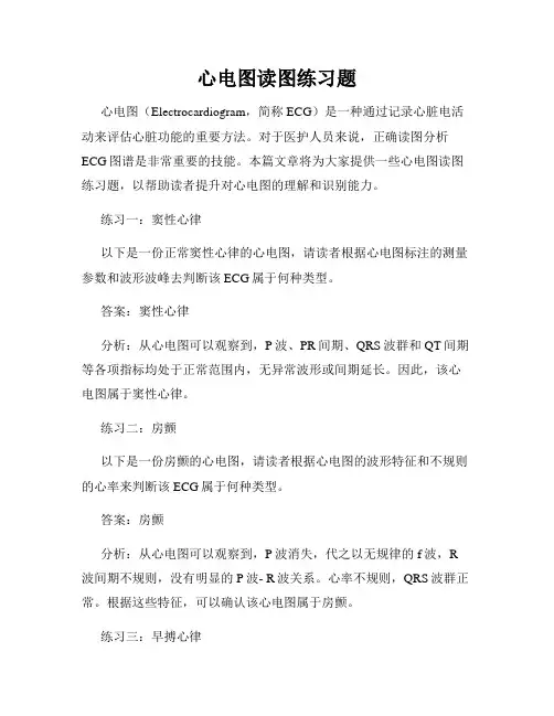 心电图读图练习题