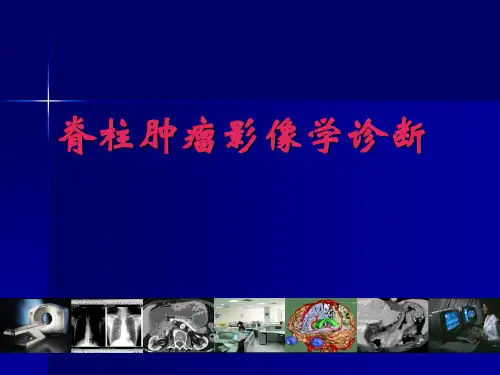 精品推荐医学影像诊断PPT课件图文详解完整版-脊柱肿瘤影像学诊断