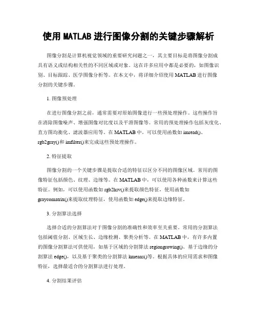 使用MATLAB进行图像分割的关键步骤解析