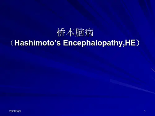 桥本氏脑病介绍