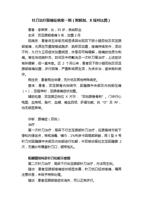 针刀治疗跟痛症病案一则（附解剖、X线对比图）