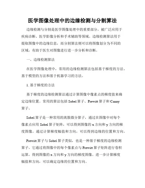 医学图像处理中的边缘检测与分割算法