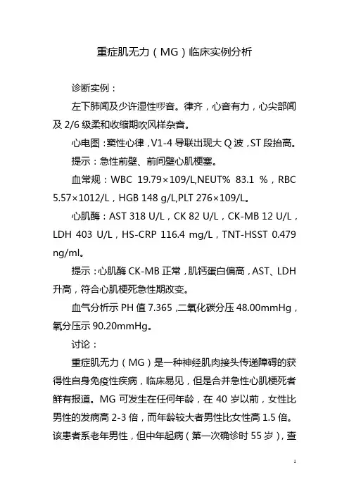重症肌无力(MG)临床实例分析