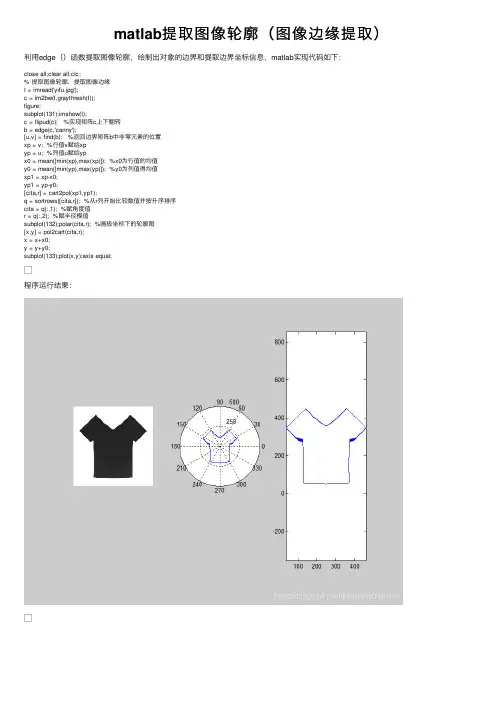 matlab提取图像轮廓（图像边缘提取）