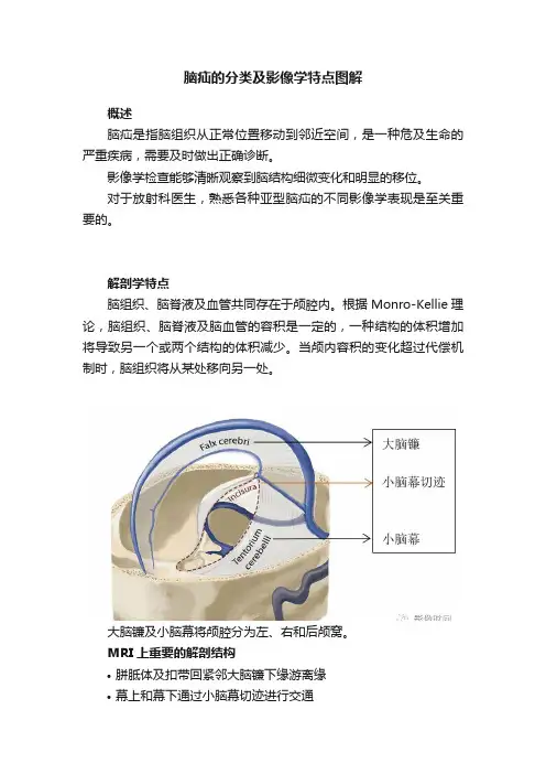 脑疝的分类及影像学特点图解