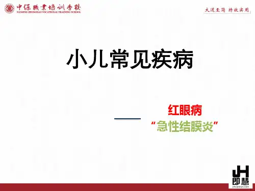 小儿红眼病的中医调理