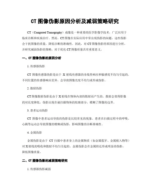 CT图像伪影原因分析及减弱策略研究