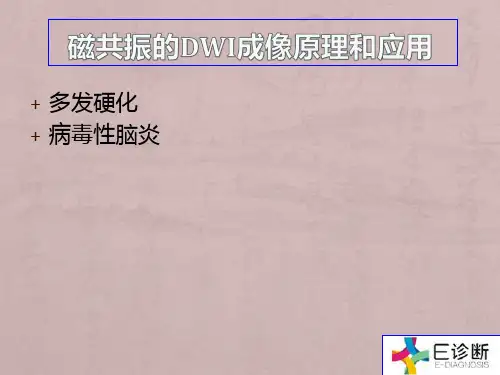 医学影像-多发性硬化、病毒性脑炎DWI影像
