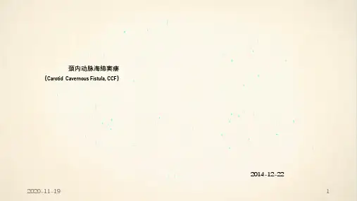 颈内动脉海绵窦瘘-讲课(最新课件)