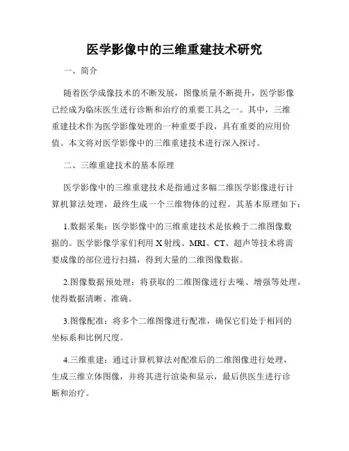 医学影像中的三维重建技术研究