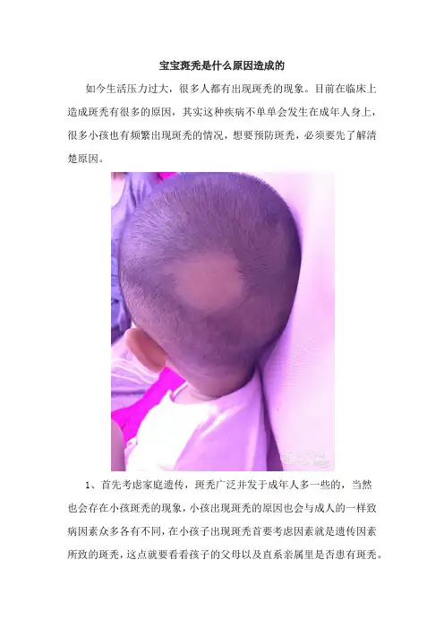 宝宝斑秃是什么原因造成的