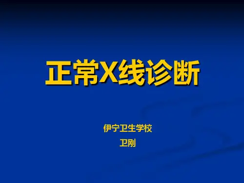 X线诊断
