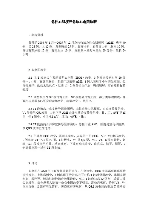 急性心肌梗死急诊心电图诊断