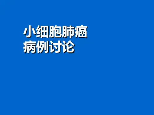 小细胞肺癌病例讨论