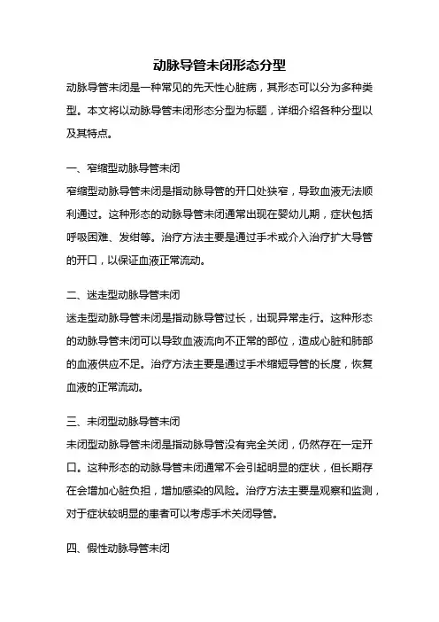 动脉导管未闭形态分型