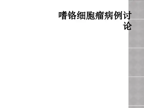 嗜铬细胞瘤病例讨论