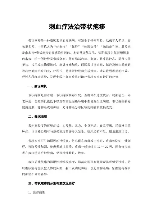 刺血疗法治带状疱疹