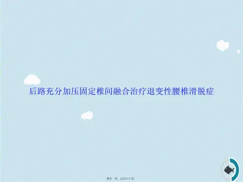 后路充分加压固定椎间融合治疗退变性腰椎滑脱症讲课文档