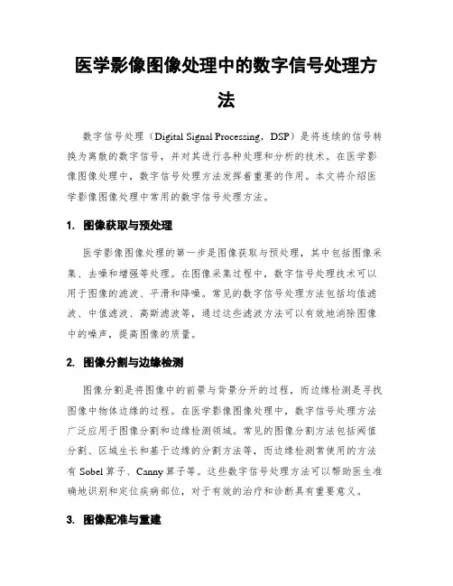医学影像图像处理中的数字信号处理方法