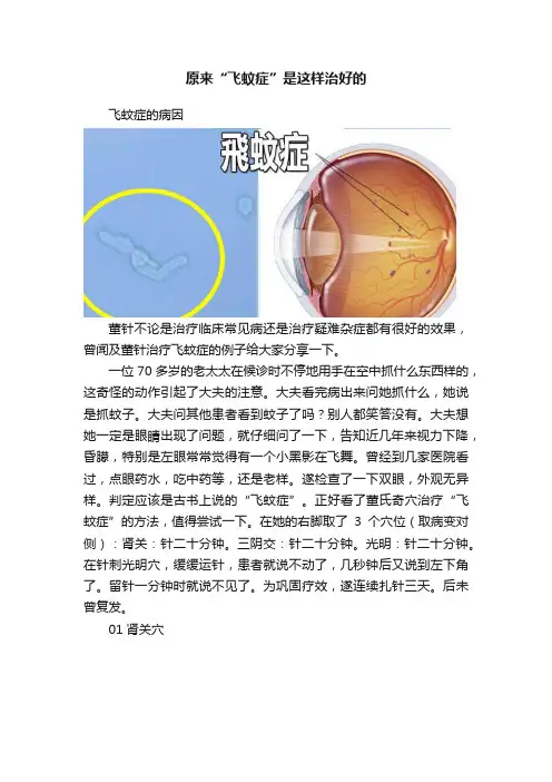 原来“飞蚊症”是这样治好的