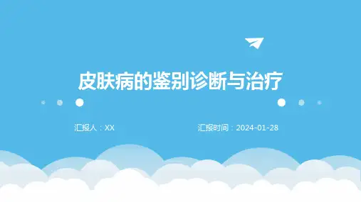皮肤病的鉴别诊断与治疗