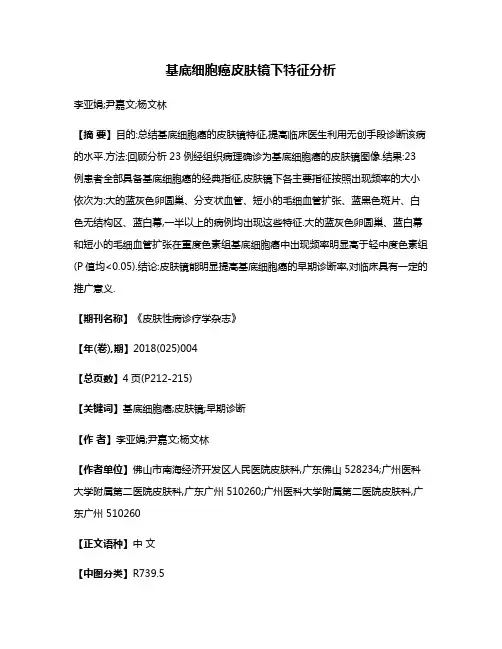 基底细胞癌皮肤镜下特征分析