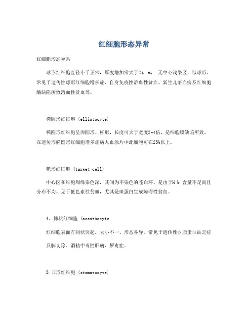 红细胞形态异常