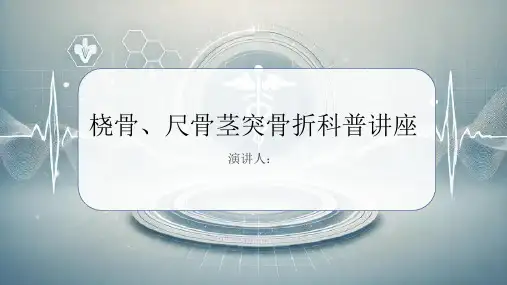 桡骨、尺骨茎突骨折科普讲座PPT课件