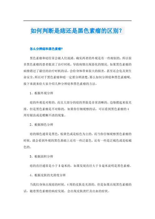 如何判断是痣还是黑色素瘤的区别？