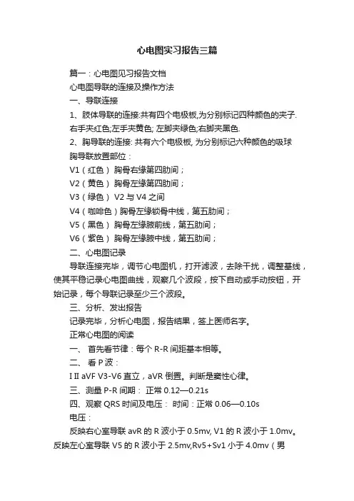 心电图实习报告三篇