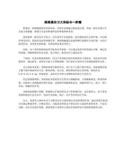 病理课实习大体标本--肿瘤
