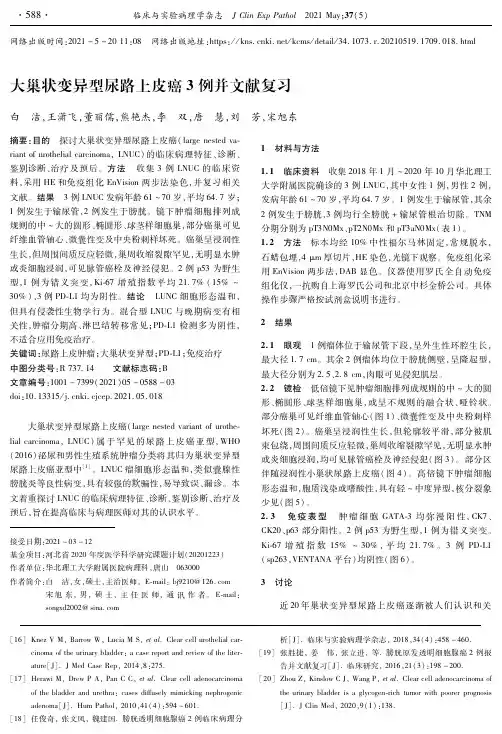 大巢状变异型尿路上皮癌3例并文献复习