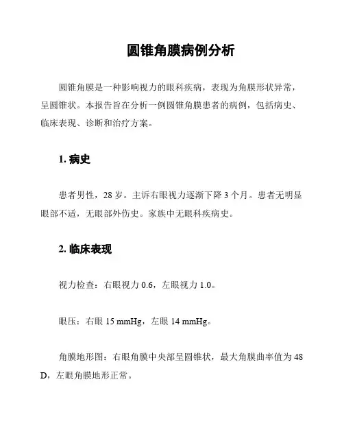 圆锥角膜病例分析