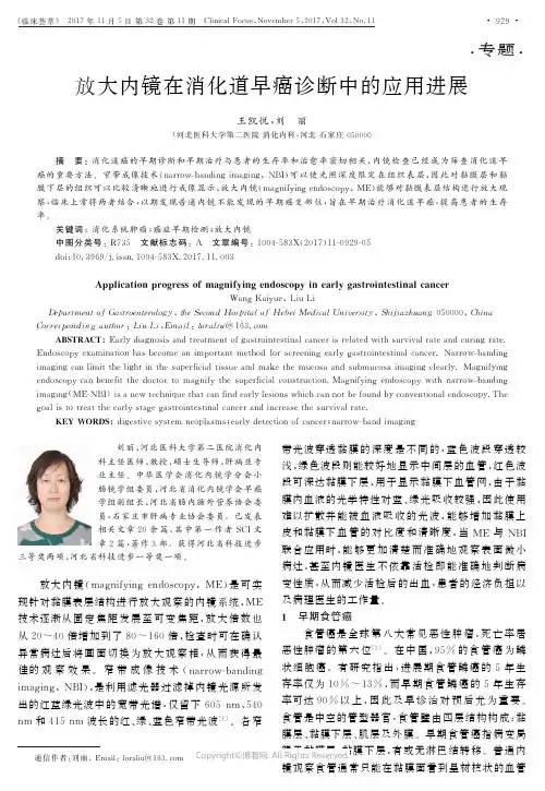 放大内镜在消化道早癌诊断中的应用进展_____