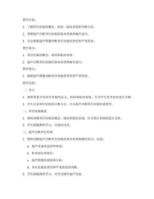 超声异位妊娠教案模板范文