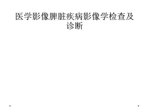 医学影像脾脏疾病影像学检查及诊断
