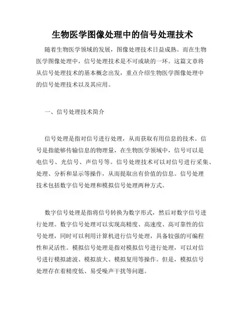 生物医学图像处理中的信号处理技术