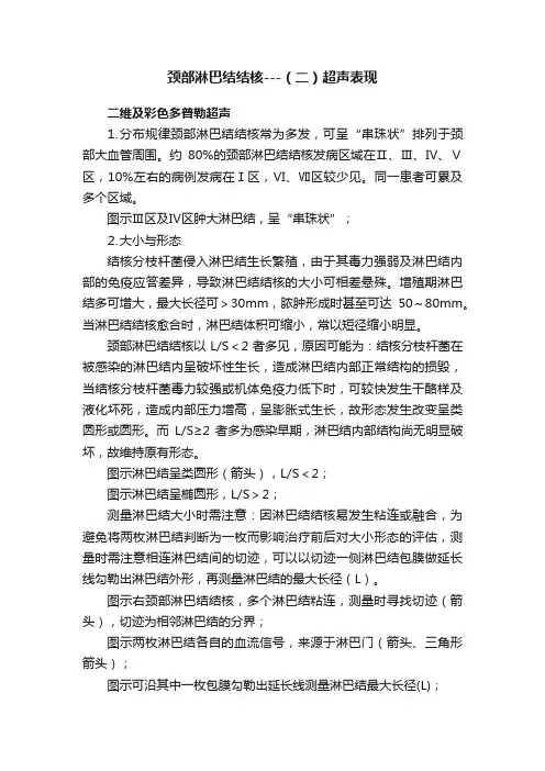 颈部淋巴结结核---（二）超声表现