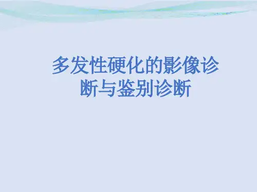 多发性硬化的影像学诊断与鉴别诊断