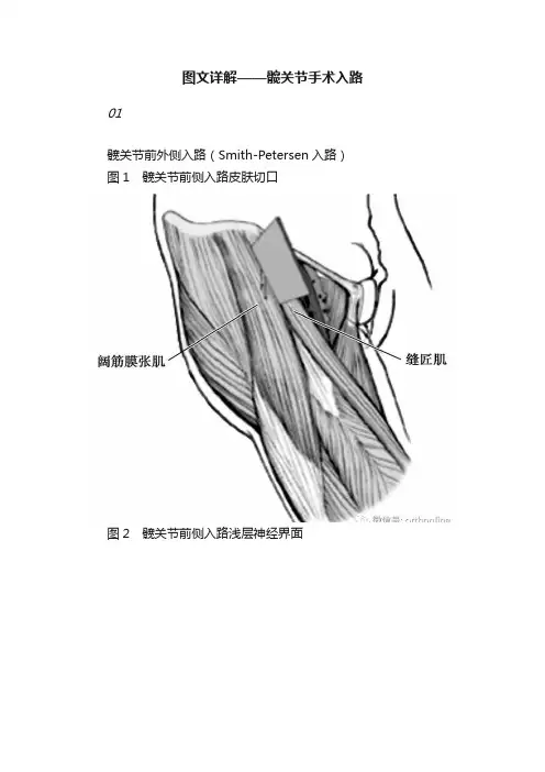 图文详解——髋关节手术入路