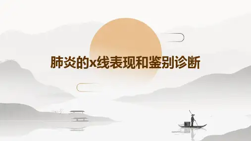 肺炎的X线表现和鉴别诊断