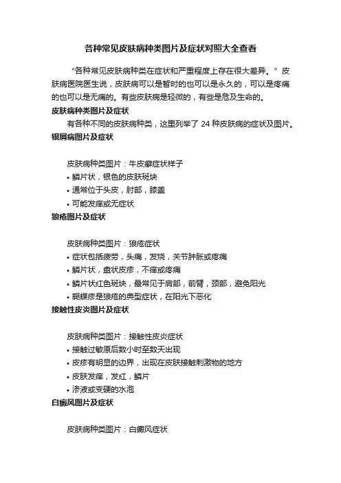 各种常见皮肤病种类图片及症状对照大全查看