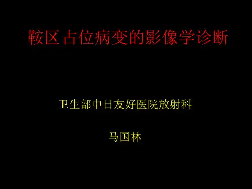 鞍区占位病变鞍内162页PPT