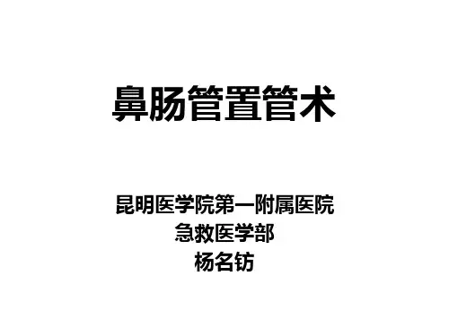 鼻肠管置管术