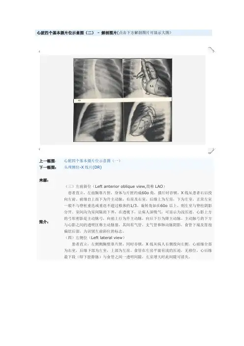 心脏四个基本摄片位示意图(二) - 解剖图片