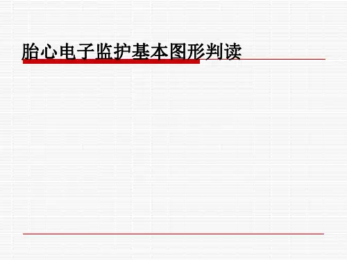 胎心电子监护基本图形判读